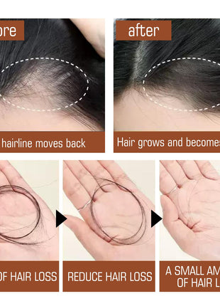 Batana Oil From Honduras - Get Fuller, Thicker, Healthier Hair - Great Gifts For Women  Men Conditioner Haircare Silky - Hair Nutrition