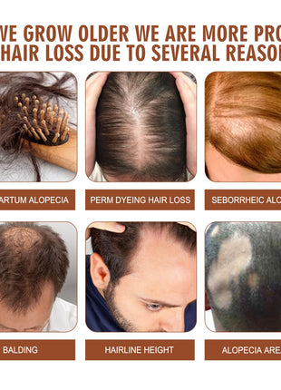 Batana Oil From Honduras - Get Fuller, Thicker, Healthier Hair - Great Gifts For Women  Men Conditioner Haircare Silky - Hair Nutrition