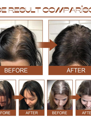 Batana Oil From Honduras - Get Fuller, Thicker, Healthier Hair - Great Gifts For Women  Men Conditioner Haircare Silky - Hair Nutrition